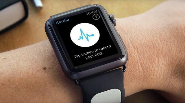 Apple Watch okosóra - diabétesz, cukorbetegség