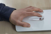Szúrás nélküli vércukormérés Szúrás nélküli vércukormérés