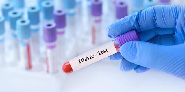 HbA1c HbA1c