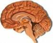 Agyvérzés avagy agyi érkatasztrófa A diabétesz és a stroke