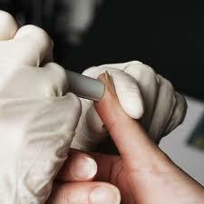 HbA1c, HbA1c szint, HbA1c, HbA1c szint,