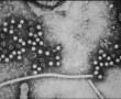 Hepatitis-E vírus Hepatitis-E vírus