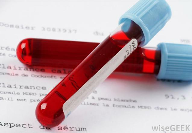 Metabolikus szindróma Metabolikus szindróma