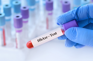 HbA1c HbA1c