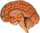 Agyvérzés avagy agyi érkatasztrófa A diabétesz és a stroke