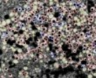inzulin granulák A NASA a cukorbetegség ellen