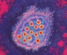 A Hepatitis megelőzése A Hepatitis megelőzése