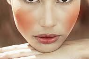 rosacea, rosaceás bőr, rosacea, rosaceás bőr,