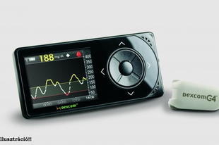 DEXCOM G4 típusú vevőegységet DEXCOM G4 típusú vevőegységet