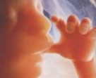 A kilenc leggyakoribb fejlődési rendellenesség A kilenc leggyakoribb fejlődési rendellenesség