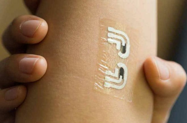 Az inzulin injekciót tetoválás válthatja fel